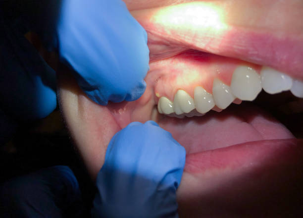 Best Broken or Cracked Tooth Emergency Dentist in Midway, AR